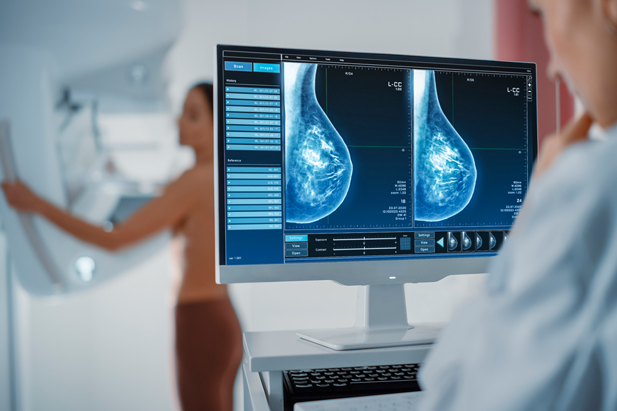 Чем маммография отличается от УЗИ молочных желез, рассказал рентгенолог