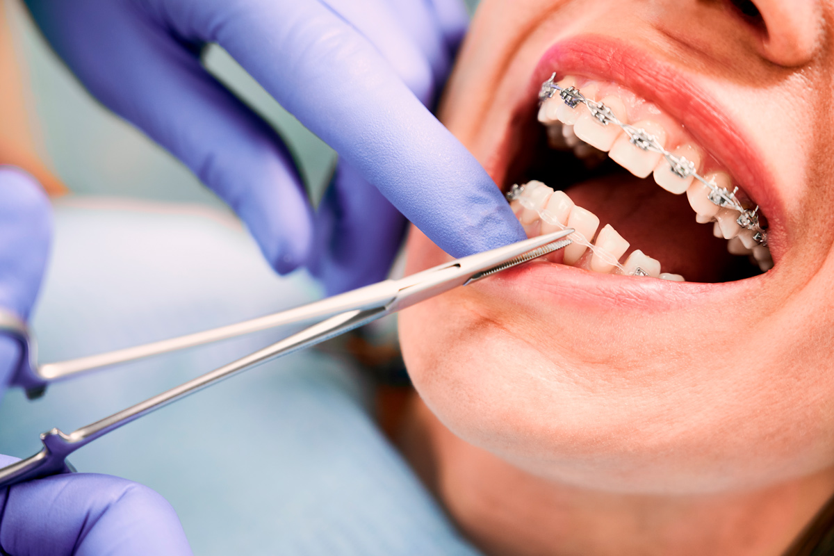 Тарифы на все стоматологические услуги теперь будут регулироваться